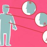 Wczesne, subtelne objawy kardiomiopatii rozstrzeniowej: sygnały ostrzegawcze, które łatwo przeoczyć